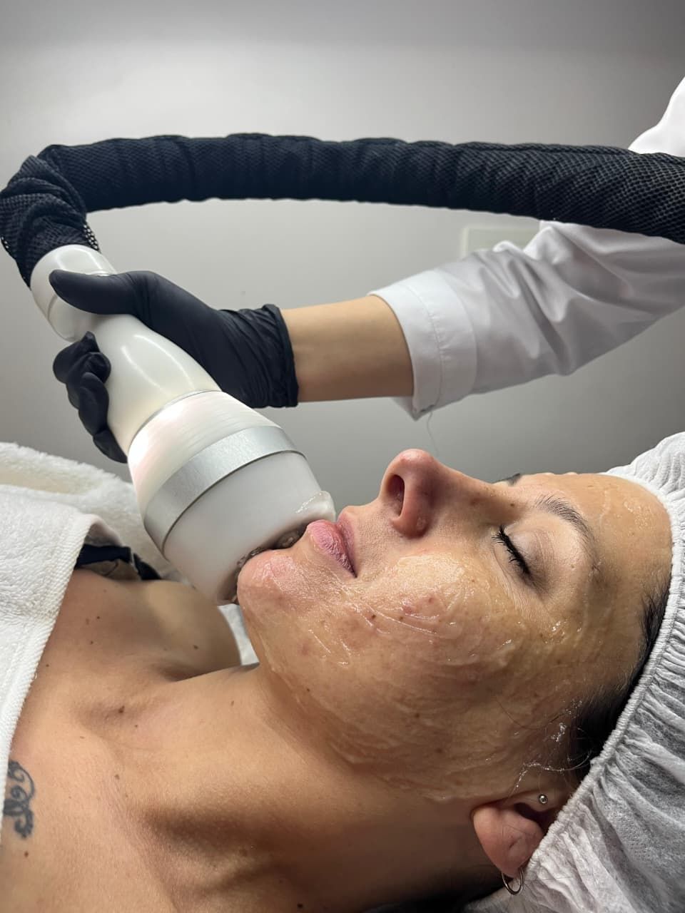 Tratamiento facial con dispositivo portátil sobre una persona tumbada, envuelta en una toalla blanca.