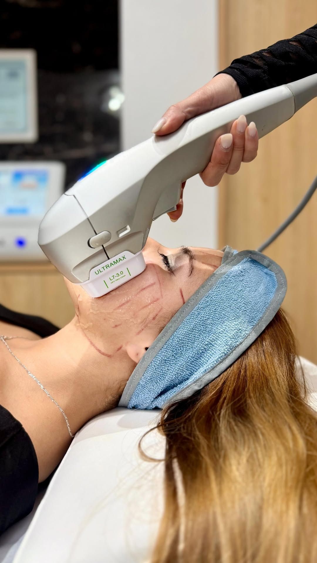 Se está realizando un tratamiento facial con un dispositivo portátil a una mujer que está tumbada boca arriba con una diadema azul.