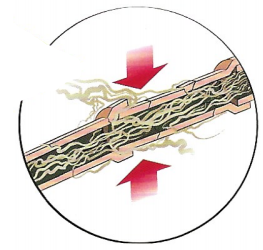 Illustration Of Root Instrusion Of Pipe - Torrington, WY - Midwest Plumbing, Inc. Illustration Of Root Instrusion Of Pipe - Torrington, WY - Midwest Plumbing, Inc.