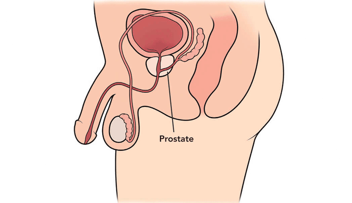 Cálculos en vías urinarias DR. JAVIER MEDRANO SÁNCHEZ