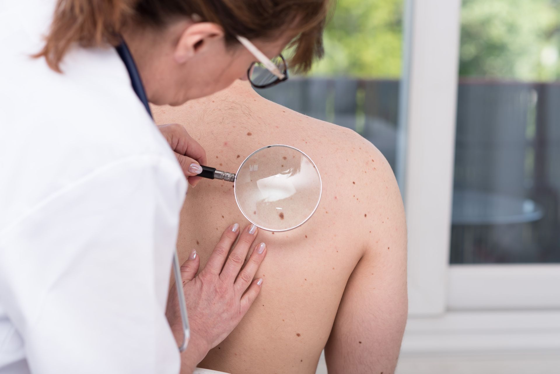 A person in a white coat uses a magnifying glass to examine moles on another person's back in a clinical setting.