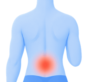 Lower back pain illustration