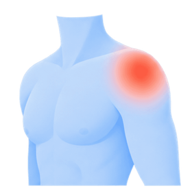 Shoulder pain illustration
