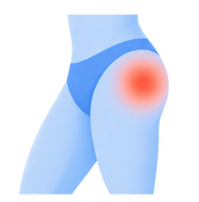 Hip pain illustration