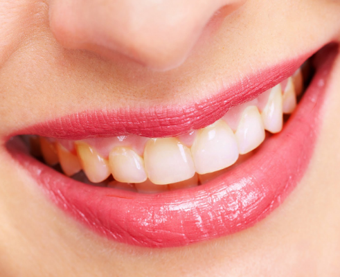 Close-up of a smiling mouth with bright pink lipstick and pearly white teeth.