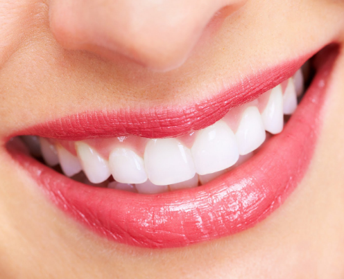 Smiling mouth with bright white teeth and red lipstick.
