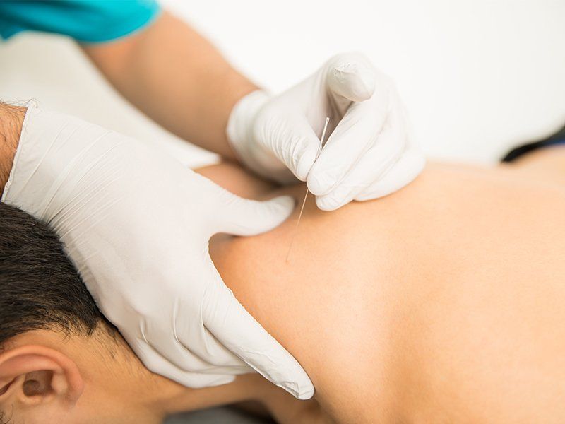 Have questions about Dry Needling Therapy provided Southwind Physical Therapy
