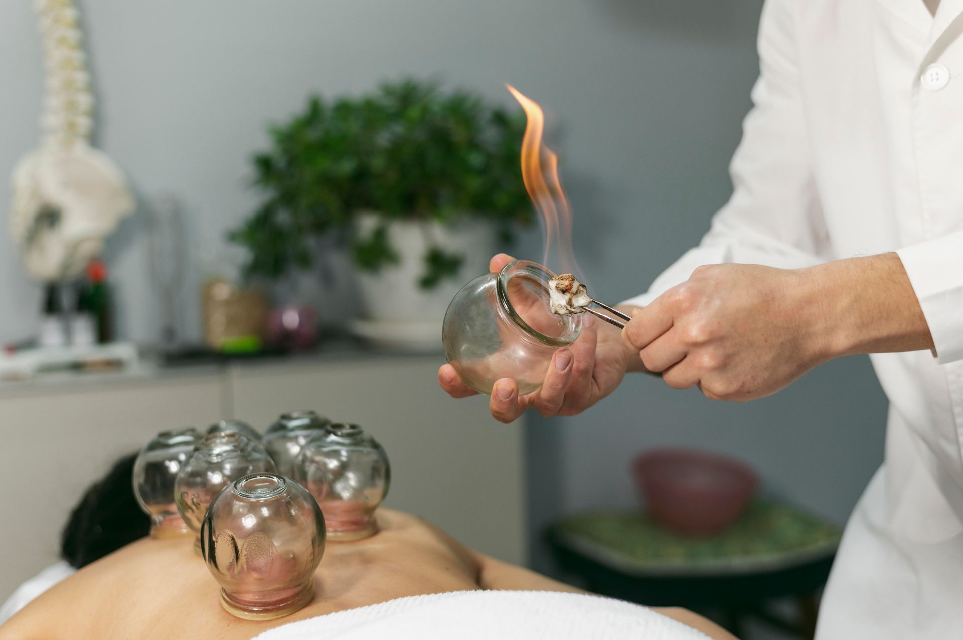 a person is getting a cupping treatment from a doctor