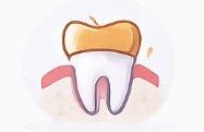 Cartoon tooth with orange crown and pink gums, isolated on white background