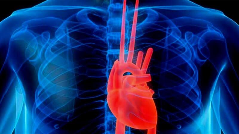 DR. RICARDO SÁNCHEZ CASTAÑEDA - ECOCARDIOGRAFÍA DOPPLER