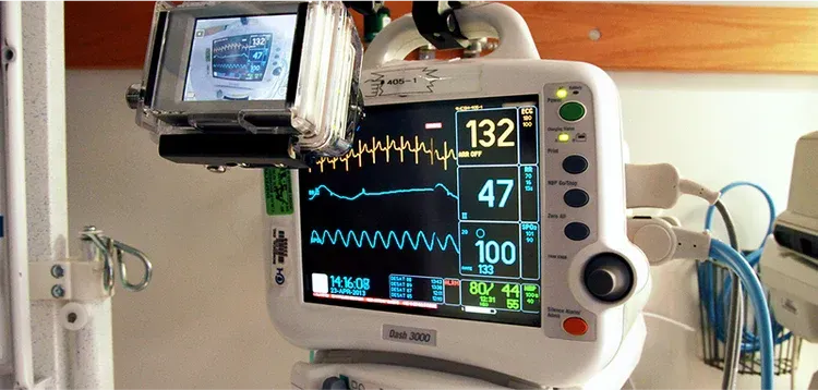 A medical monitor displays vital signs. The screen shows an EKG waveform and numeric readings.
