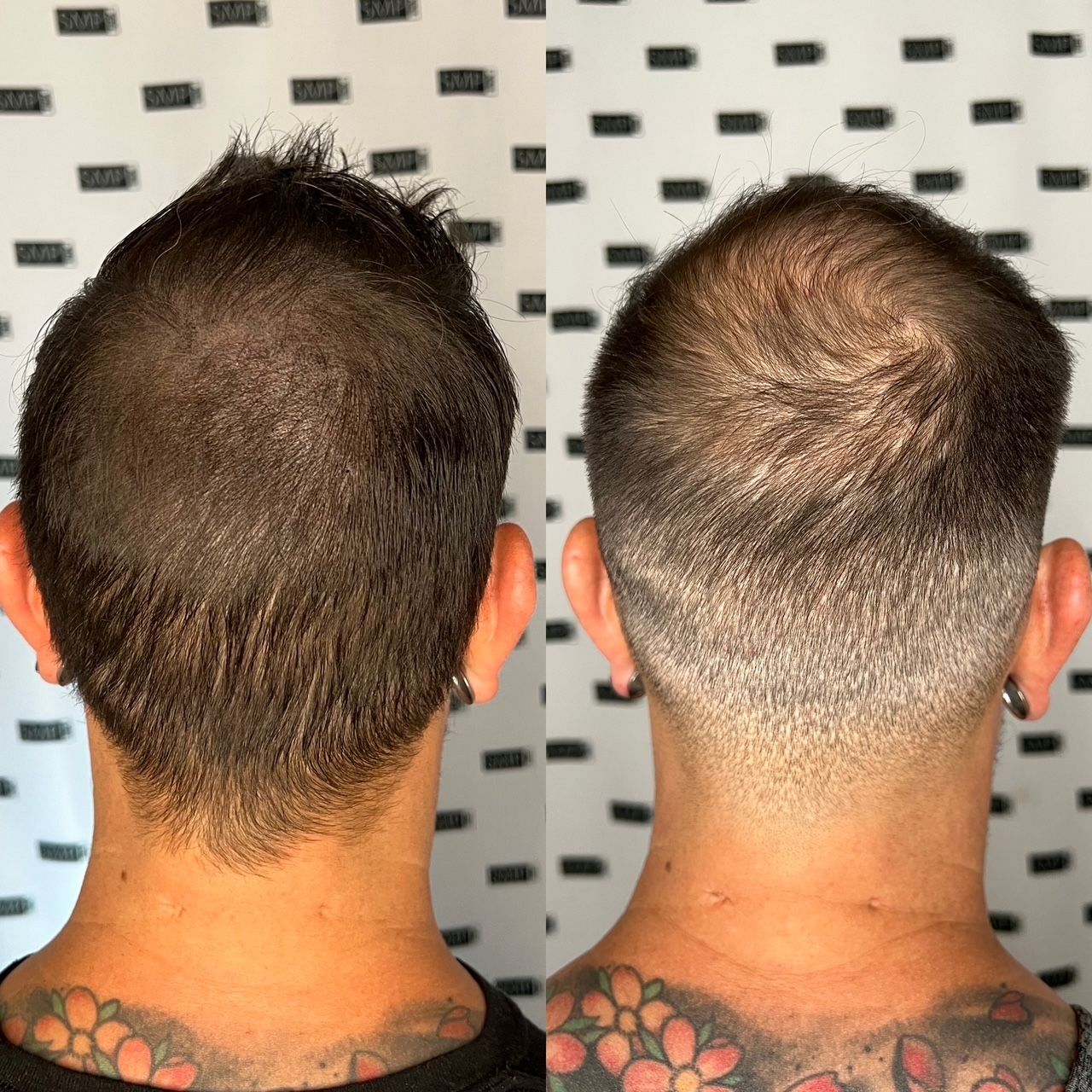 Before and after shots of the back of a person's head. Haircut shows a faded cut with visible scalp on right.