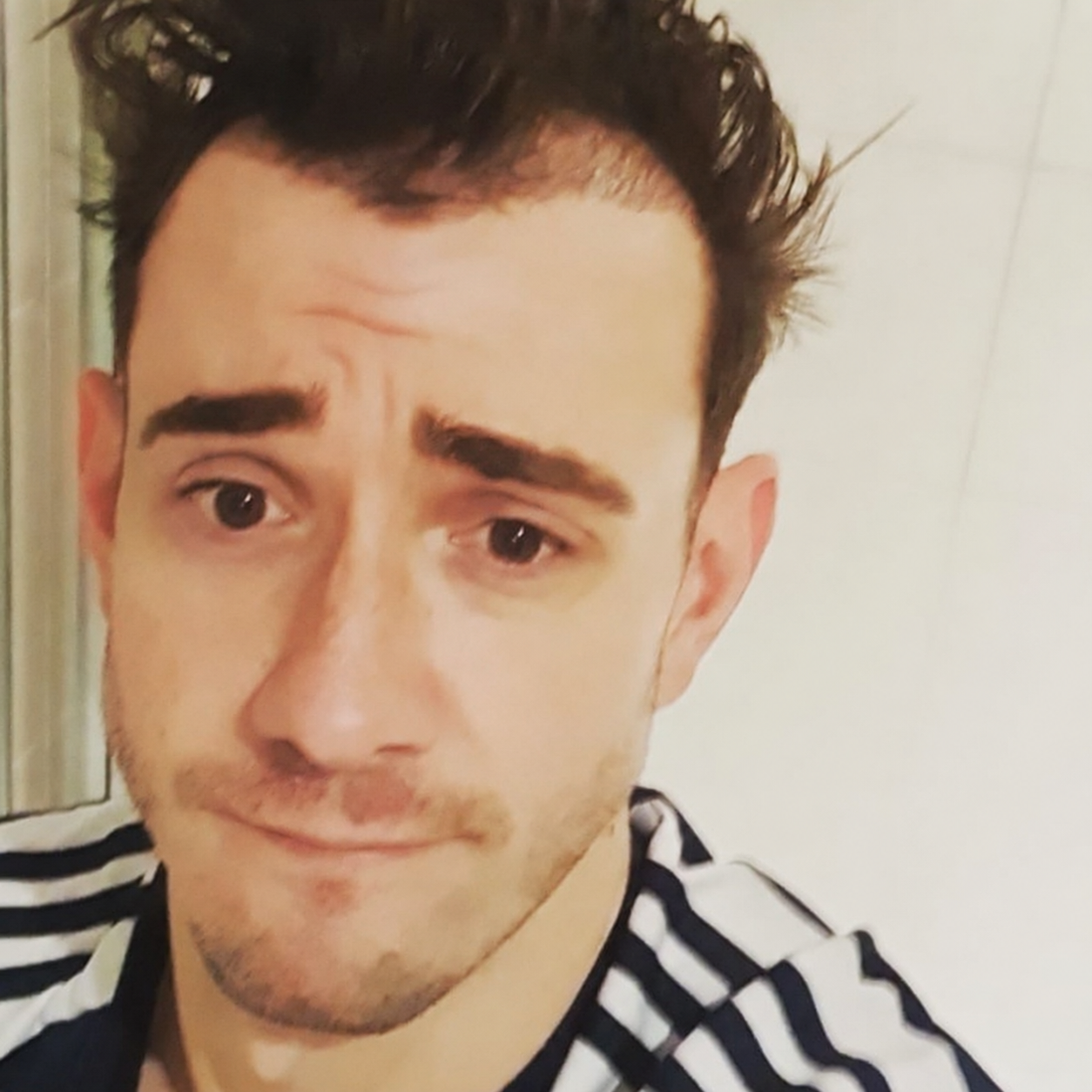 Hair transplant healing, shedding and new hair growth stages