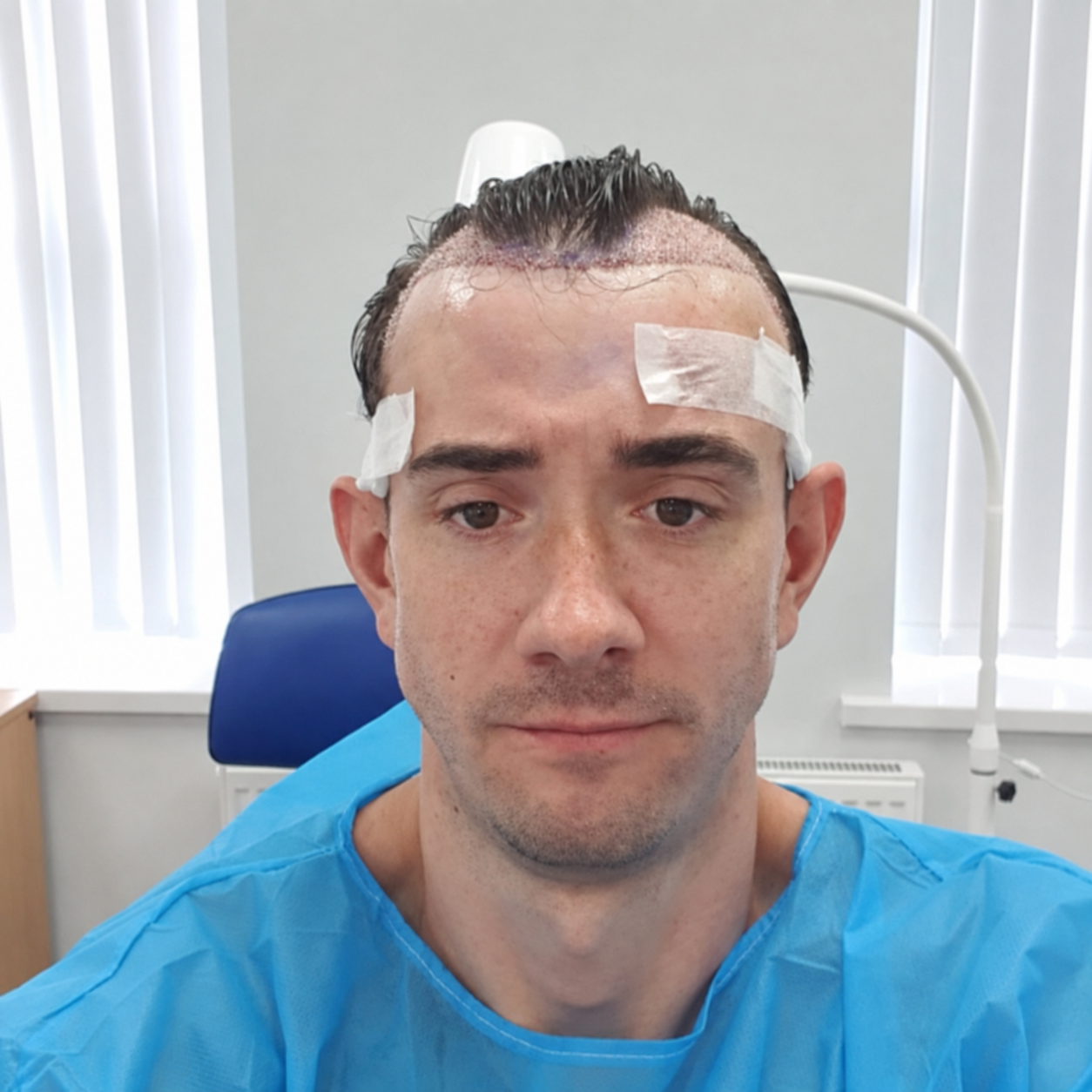 Hair transplant recovery during the first 24 hours