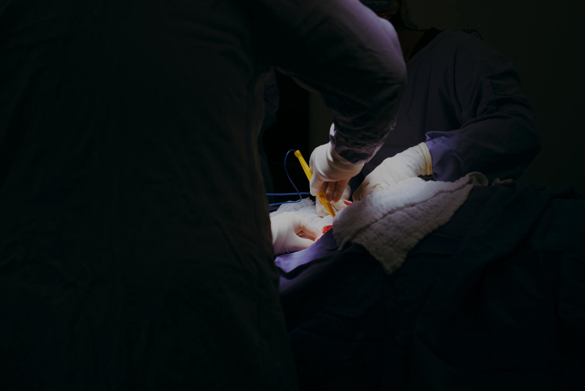 Picture of ongoing surgery.