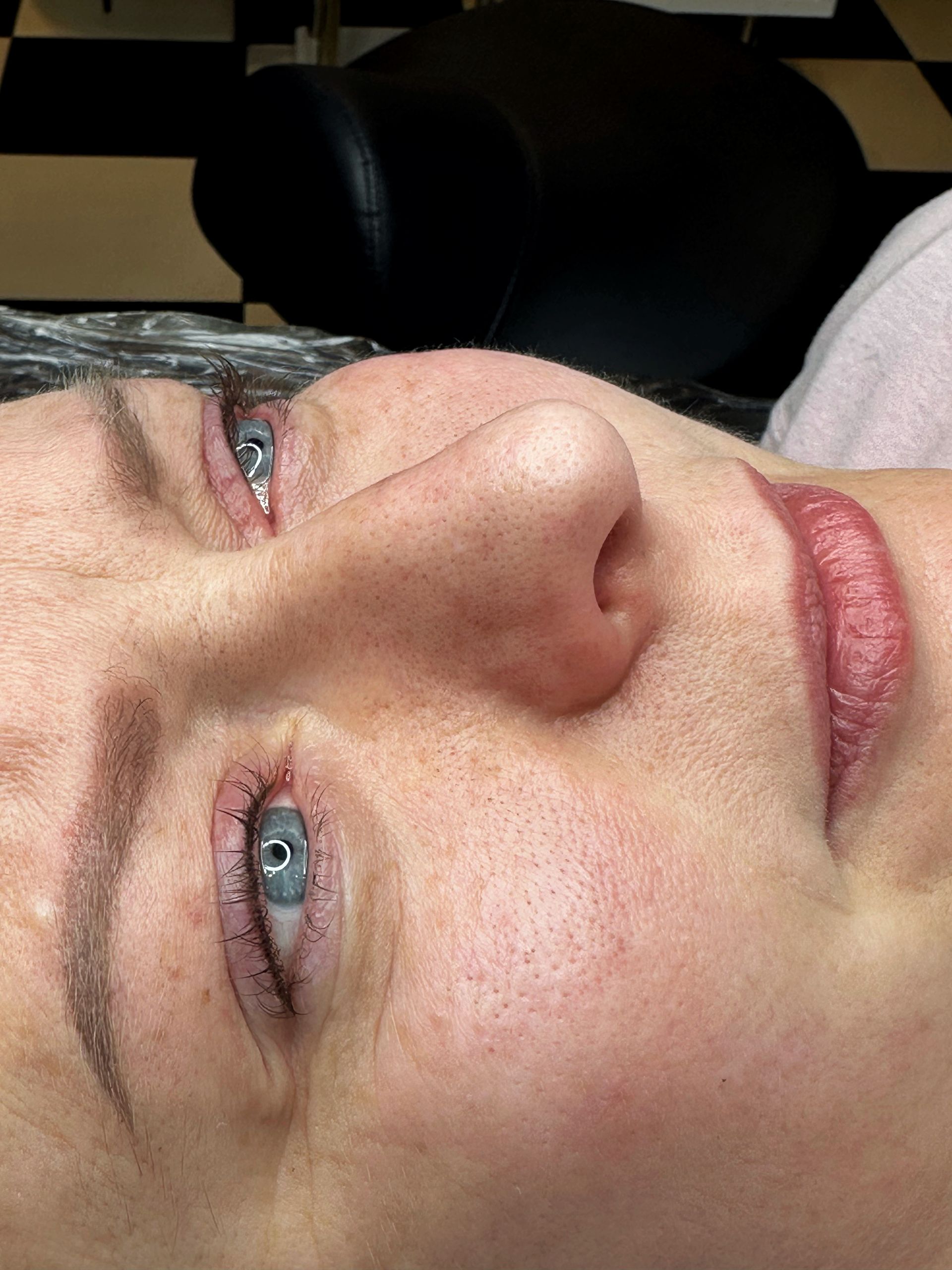 Woman with blue eyes, undergoing cosmetic procedure. Close up of face, setting is indoors.