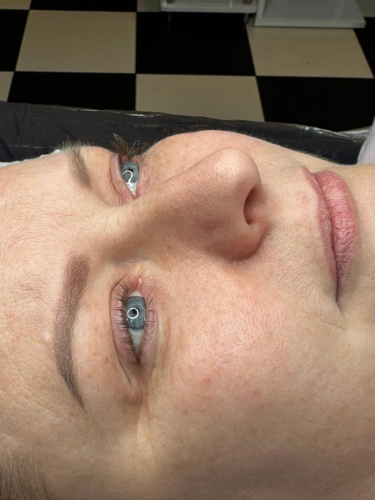 A person with light skin and blue eyes, receiving cosmetic eyebrow and lip procedures.