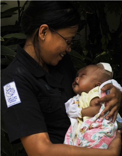 Cleft Care worker holding a baby