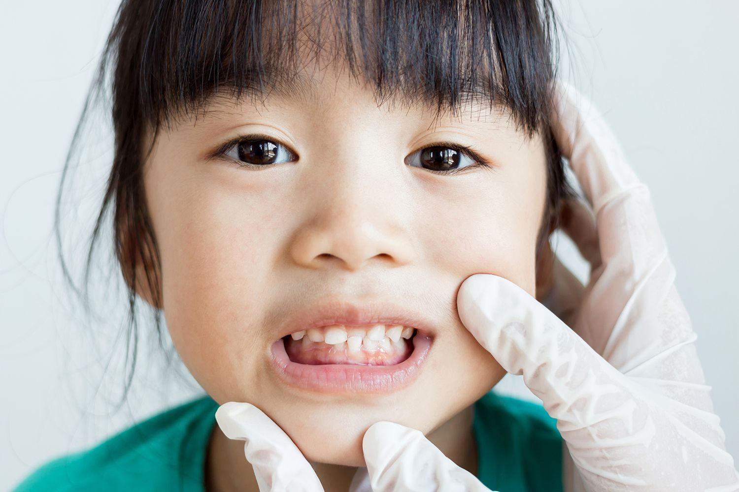Close up of a Young girl showing off her teeth
