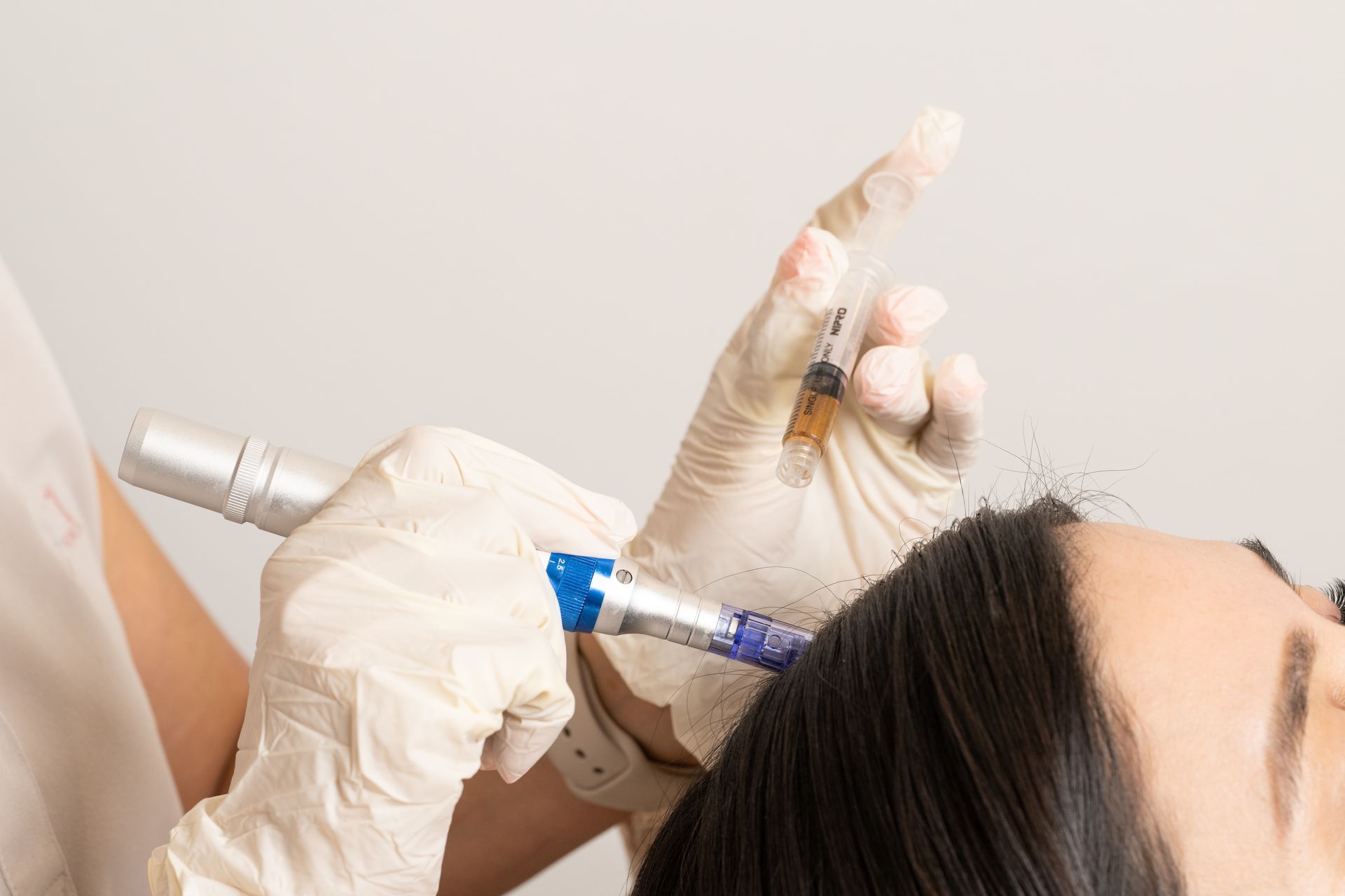 Hair Restoration