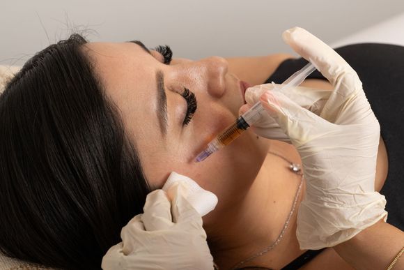 Laser hair removal