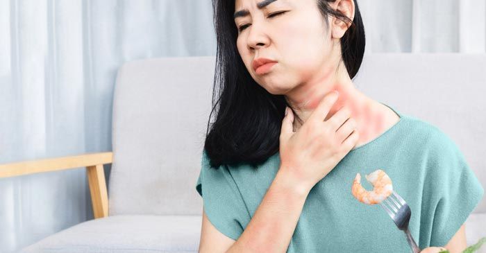 Food Allergy Remedies - Dr. Louis Granirer Holistic Chiropractor. Food Allergy Remedy in Kingston, Ulster County NY 12401