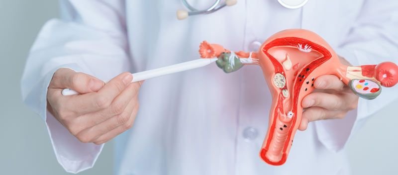 PCOS Remedies - Dr. Louis Granirer, Holistic Chiropractor. Natural Remedies for Polycystic Ovary Syndrome in Kingston, Ulster County NY 12401