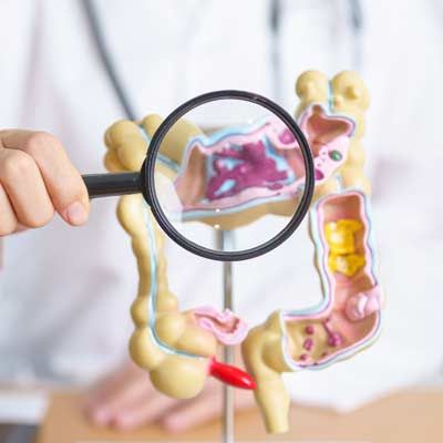 Magnifying glass over a colorful anatomical colon model showing Irritable Bowel Syndrome