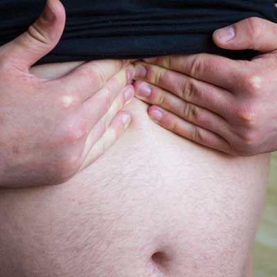 Hands pinching skin on a bare abdomen with pain from a Hiatal Hernia