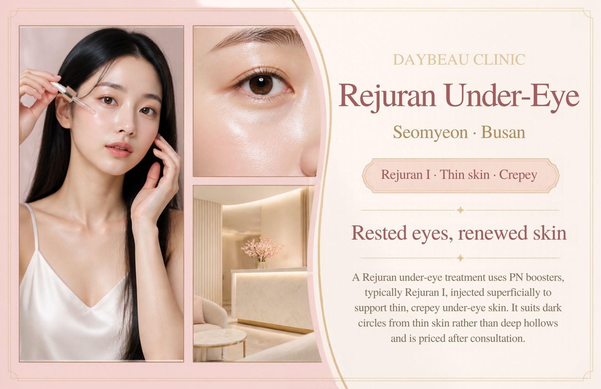 Rejuran Under-Eye at Daybeau Clinic, Seomyeon, Busan. A Rejuran under-eye treatment uses PN boosters, typically Rejuran I, injected superficially to support thin, crepey under-eye skin. It suits dark circles from thin skin rather than deep hollows and is priced after consultation.