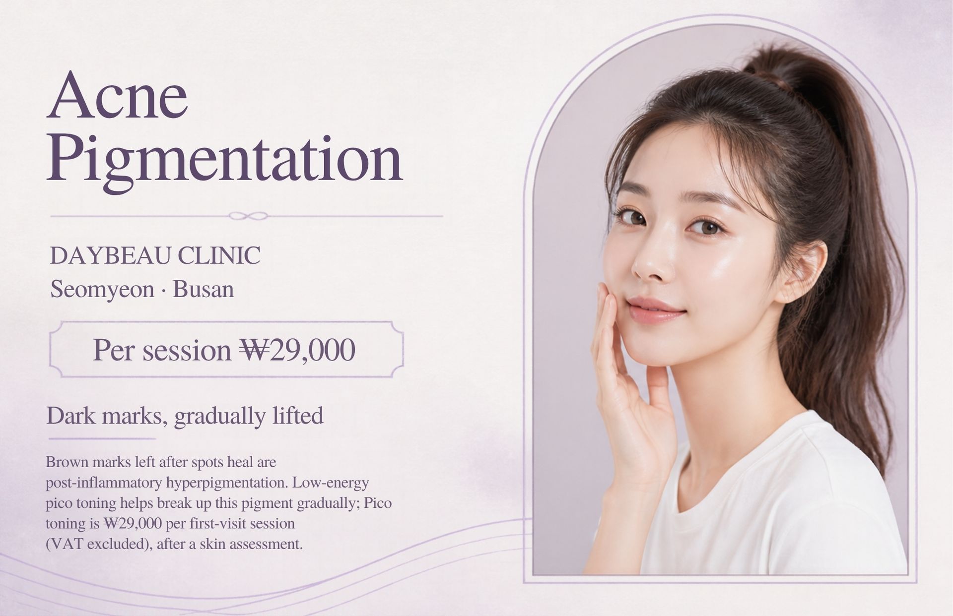 Acne Pigmentation at Daybeau Clinic, Seomyeon, Busan – first visit from ₩29,000. Brown marks left after spots heal are post-inflammatory hyperpigmentation. Low-energy pico toning helps break up this pigment gradually; Pico toning is ₩29,000 per first-visit session (VAT excluded), after a skin assessment.