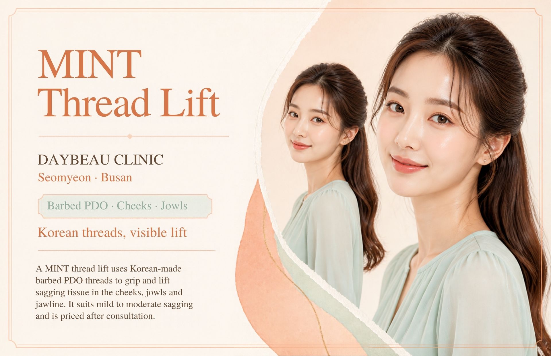MINT Thread Lift at Daybeau Clinic, Seomyeon, Busan. A MINT thread lift uses Korean-made barbed PDO threads to grip and lift sagging tissue in the cheeks, jowls and jawline. It suits mild to moderate sagging and is priced after consultation.