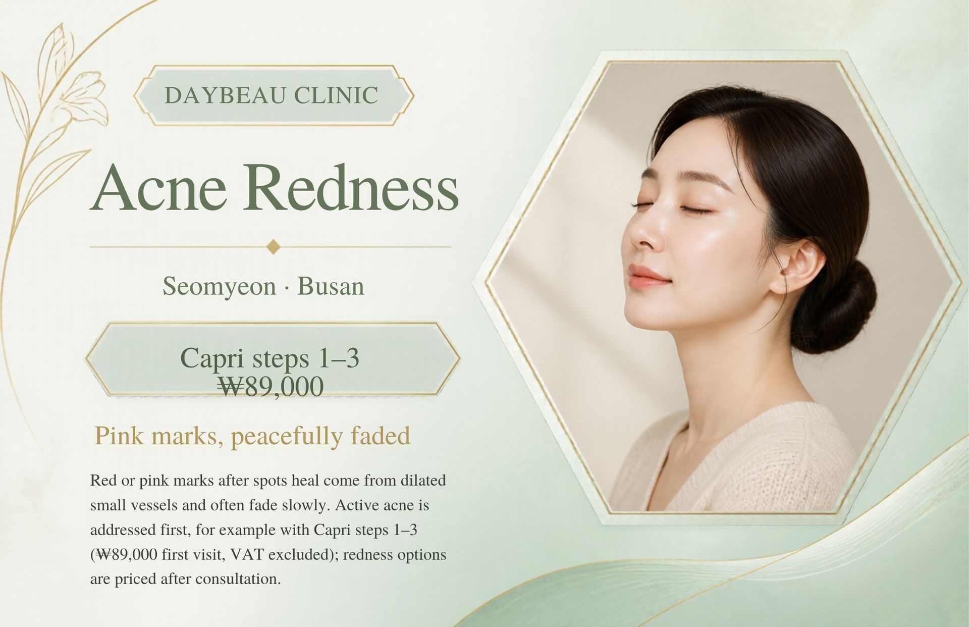 Acne Redness at Daybeau Clinic, Seomyeon, Busan – first visit from ₩89,000. Red or pink marks after spots heal come from dilated small vessels and often fade slowly. Active acne is addressed first, for example with Capri steps 1–3 (₩89,000 first visit, VAT excluded); redness options are priced after consultation.