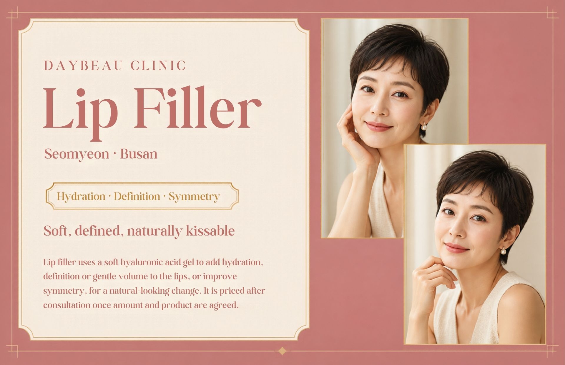 Lip Filler at Daybeau Clinic, Seomyeon, Busan. Lip filler uses a soft hyaluronic acid gel to add hydration, definition or gentle volume to the lips, or improve symmetry, for a natural-looking change. It is priced after consultation once amount and product are agreed.