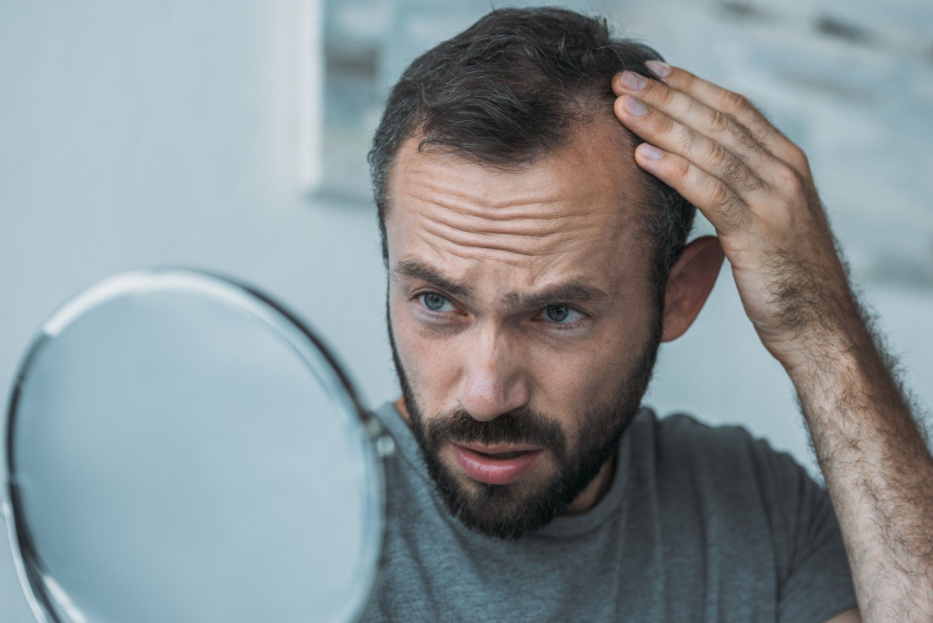 How to Prevent Hair Loss