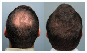 Mr. Carmine International Hair Salon