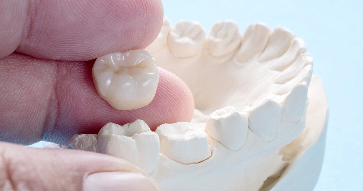 A person is holding a tooth in their hand over a model of teeth.