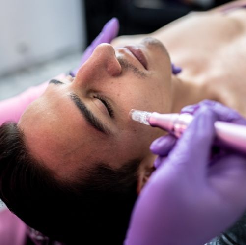 Concerns microneedling can help improve