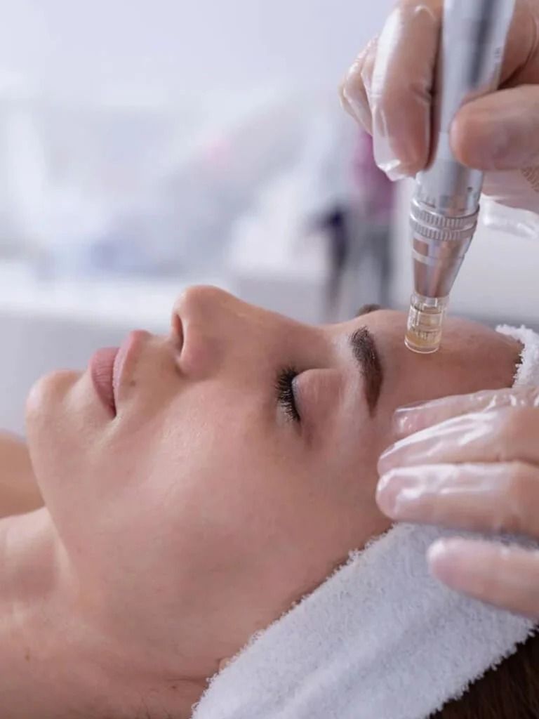 Microneedling with or without PRP