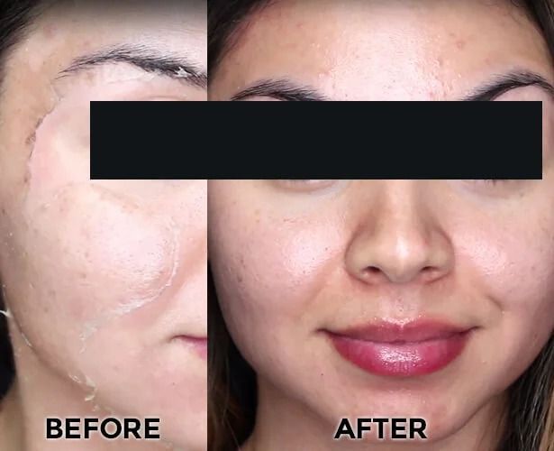 Reveal brighter, smoother skin