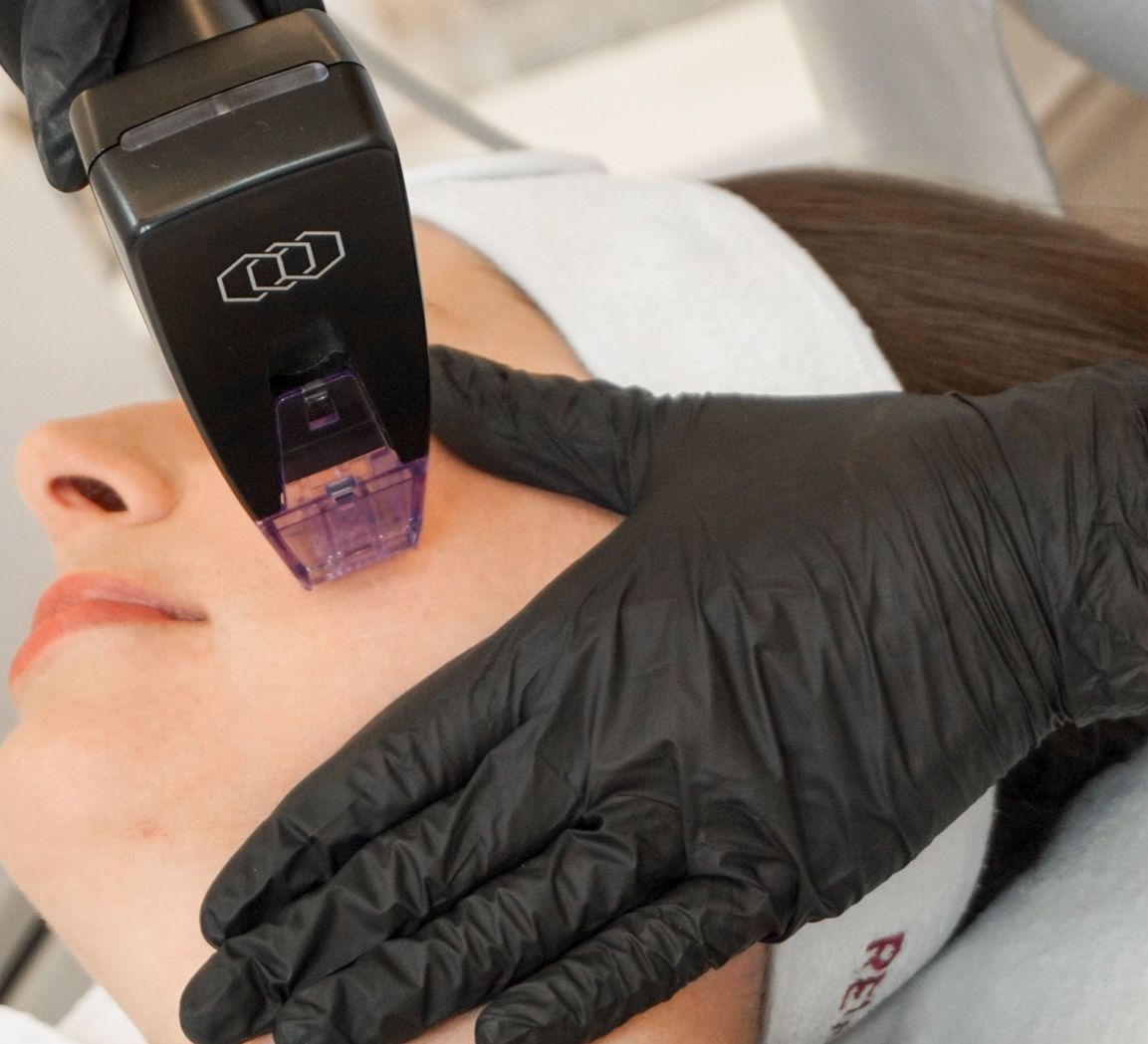 Radiofrequenz-Needling