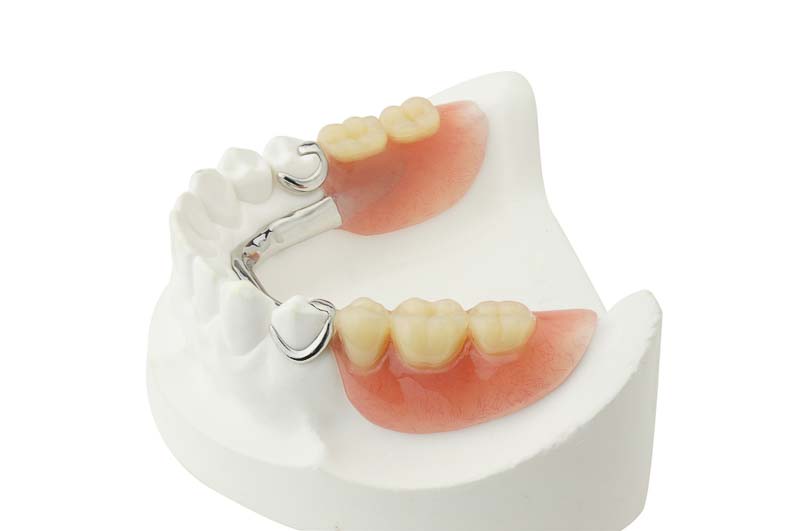 dentures