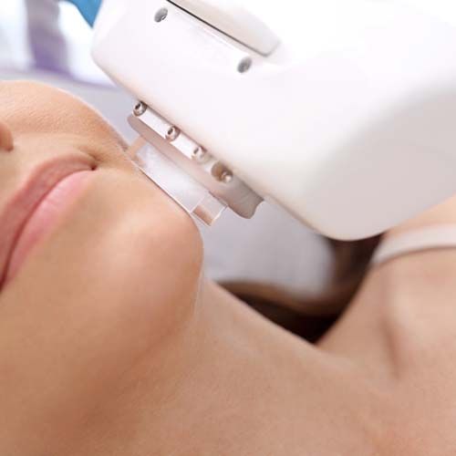 Laser Hair Reduction for Transgender People