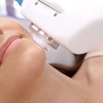 Laser Hair Reduction for Transgender People