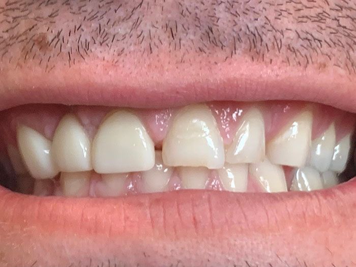 Close-up of a smiling mouth with visible teeth and lips, showing a front tooth gap.