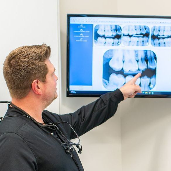Oral Cancer Screenings
