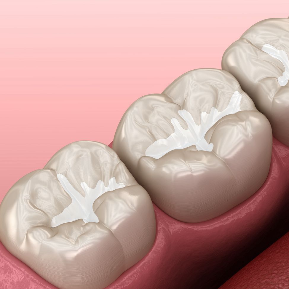 Sealants