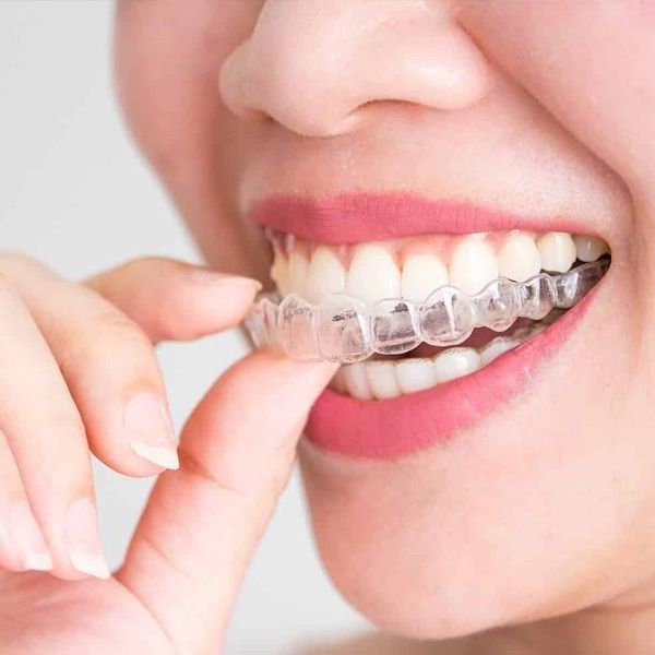 Invisalign