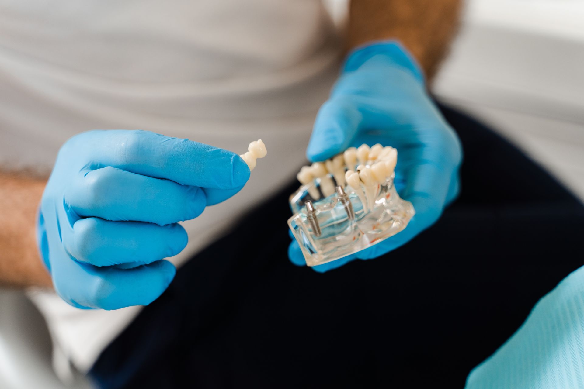 A dentist holds an artificial plastic jaw with dental implants, close-up.