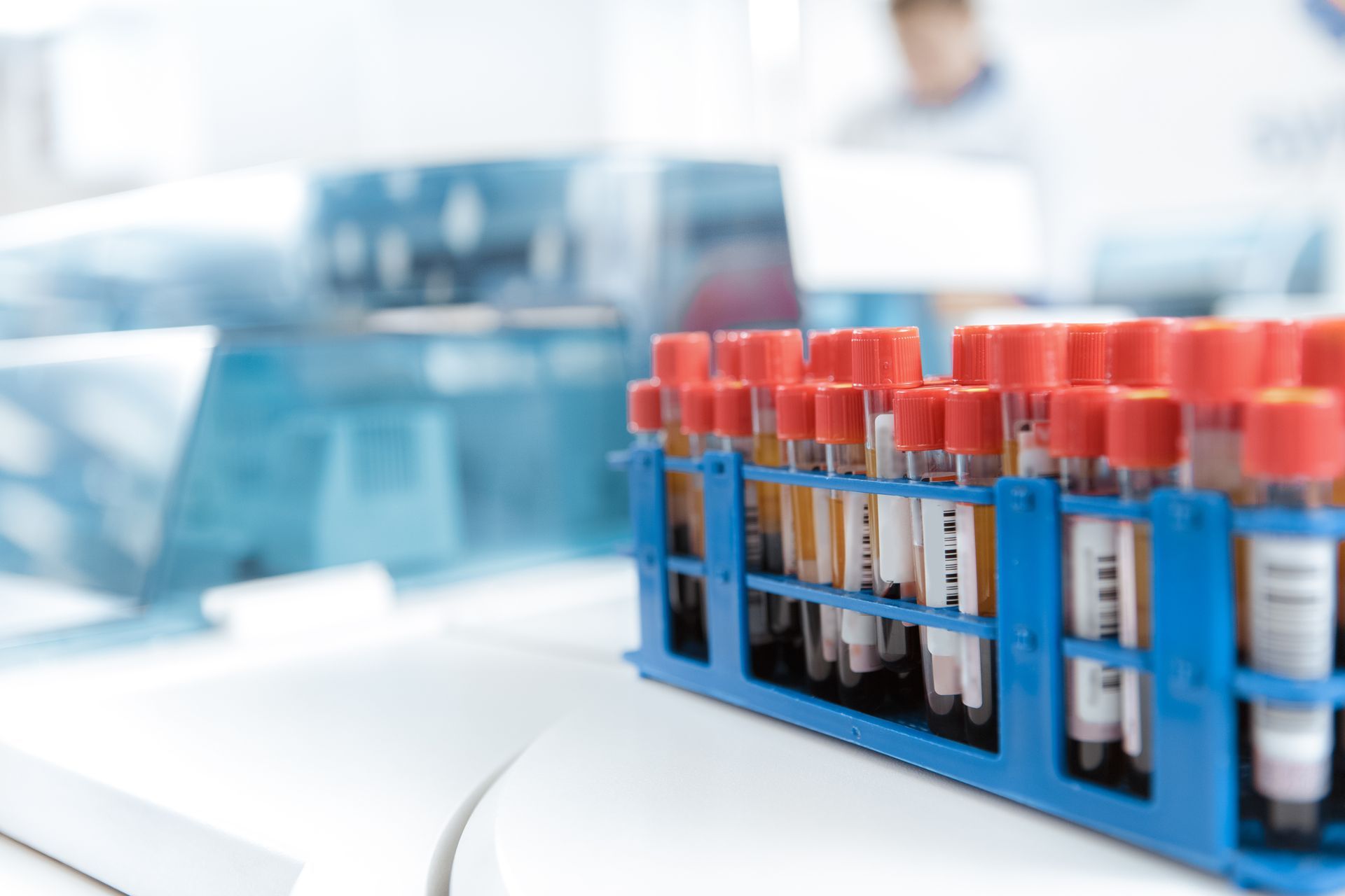 Lab Test Tubes